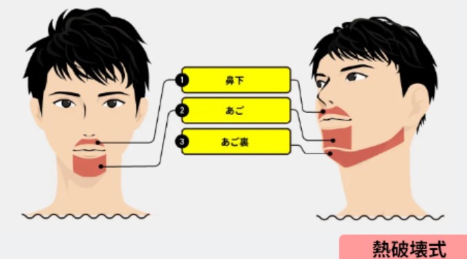 メンズリゼヒゲ3部位