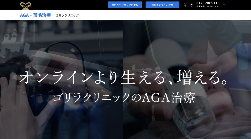 ゴリラクリニック AGA治療