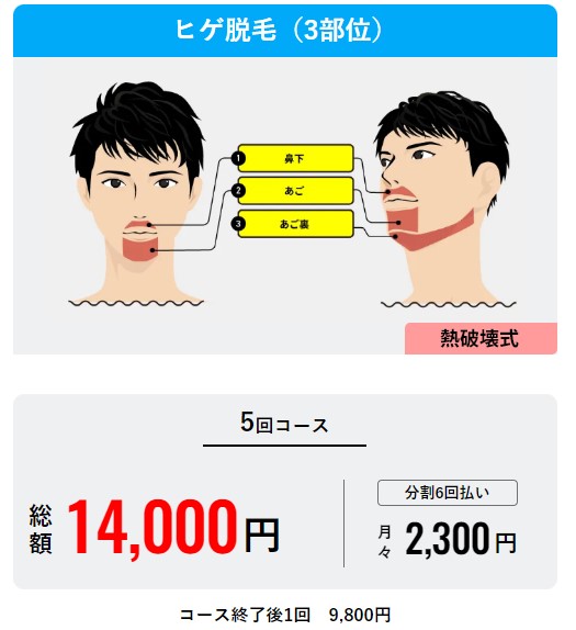 メンズリゼヒゲ脱毛「3部位」料金