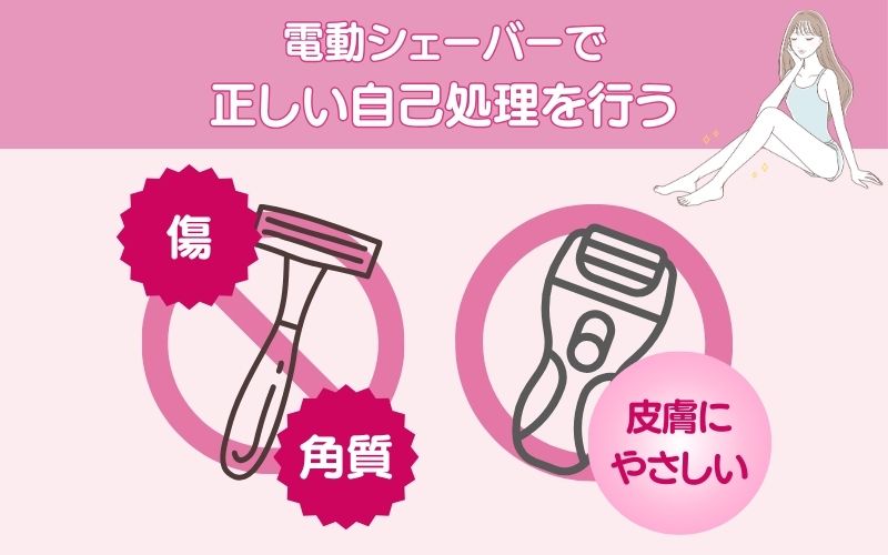 電動シェーバーで正しい自己処理を行う